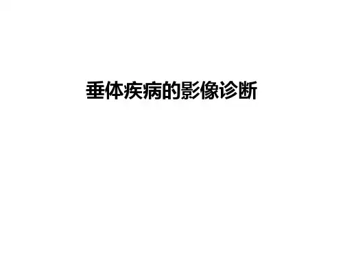 最新垂体疾病的影像诊断