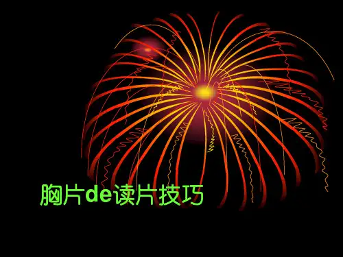 胸片读片技巧大全【医生】