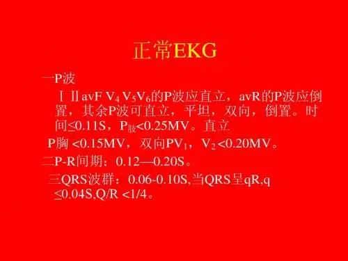 正常EKG-3