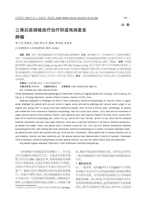 三维后装插植放疗治疗阴道残端复发肿瘤