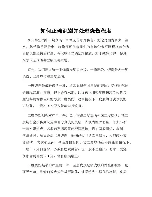如何正确识别并处理烧伤程度