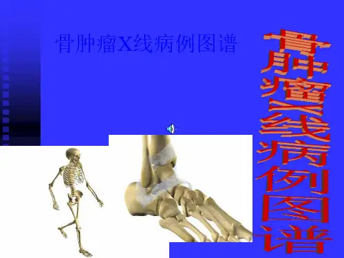 骨肿瘤X病例图谱