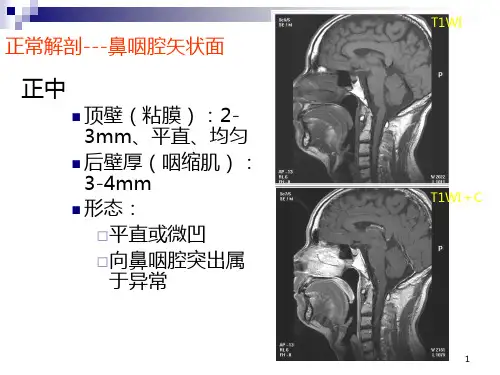 正常颈部解剖PPT课件