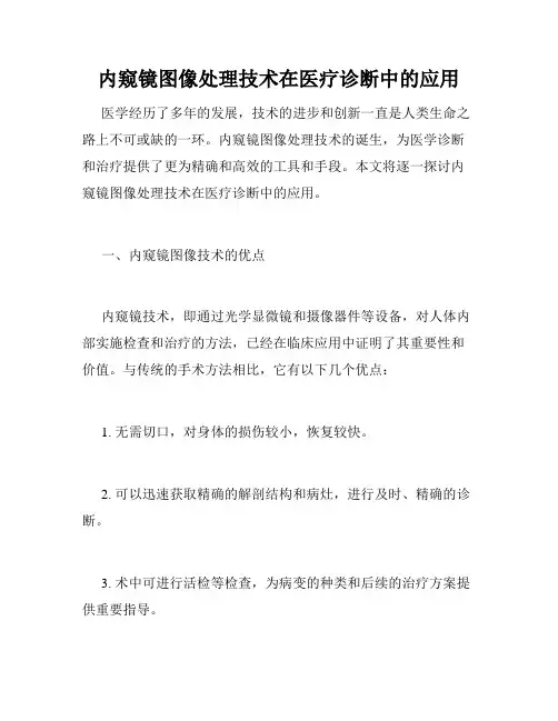 内窥镜图像处理技术在医疗诊断中的应用