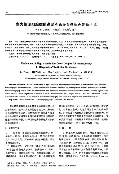 睾丸精原细胞瘤的高频彩色多普勒超声诊断价值