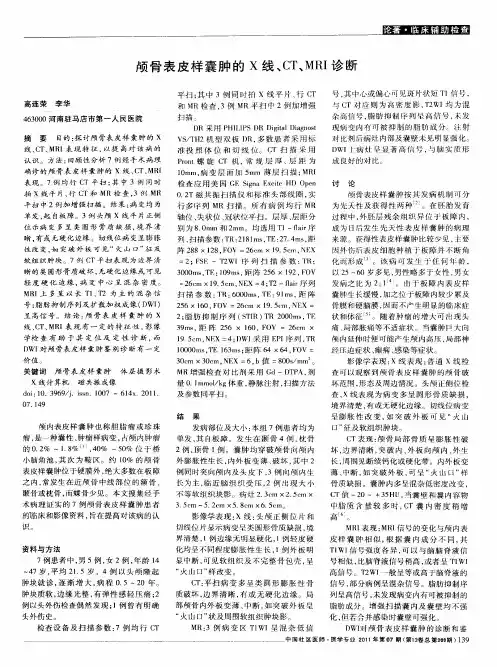 颅骨表皮样囊肿的X线、CT、MRI诊断