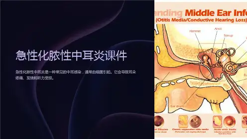 急性化脓性中耳炎课件