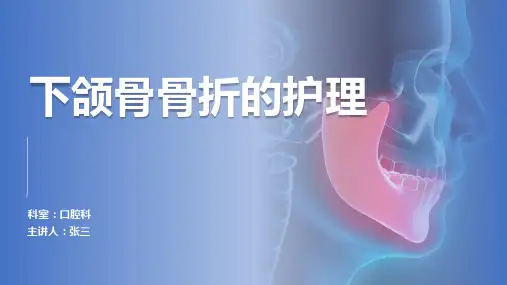 下颌骨骨折的护理ppt