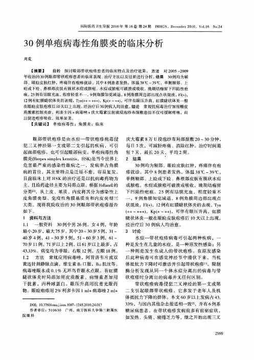 30例单疱病毒性角膜炎的临床分析