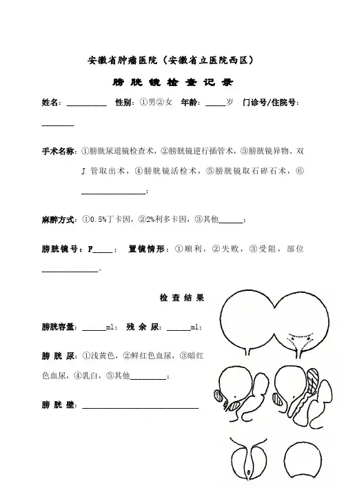 膀胱镜检查记录和膀胱镜检查知情同意书