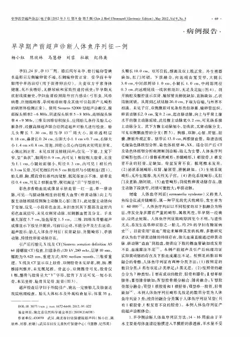 早孕期产前超声诊断人体鱼序列征一例