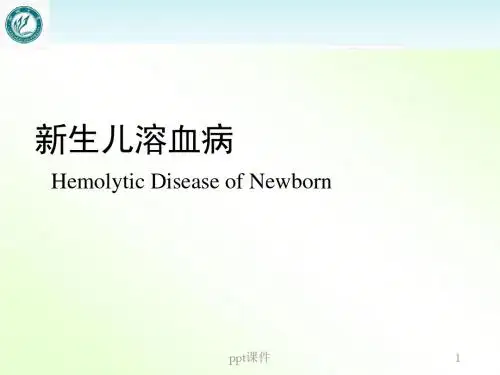 新生儿溶血病 ppt课件