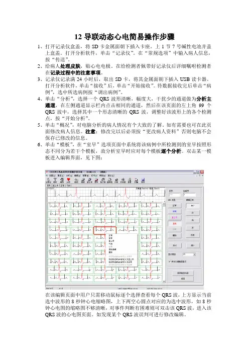 12导联动态心电简易操作步骤
