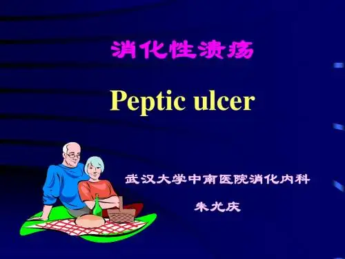 消化性溃疡