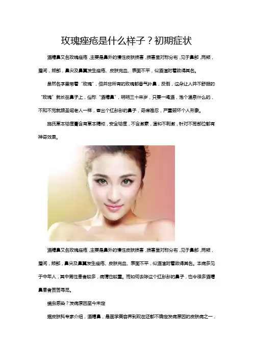 玫瑰痤疮图片是什么样子？初期症状