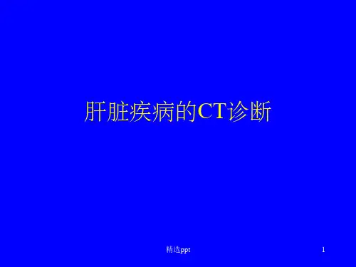 腹部CT的读片报告