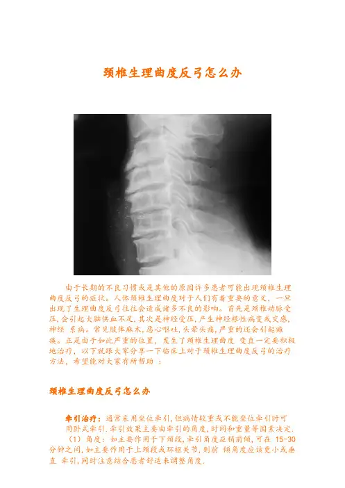 颈椎生理曲度反弓怎么办