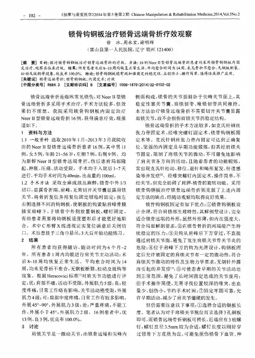 锁骨钩钢板治疗锁骨远端骨折疗效观察