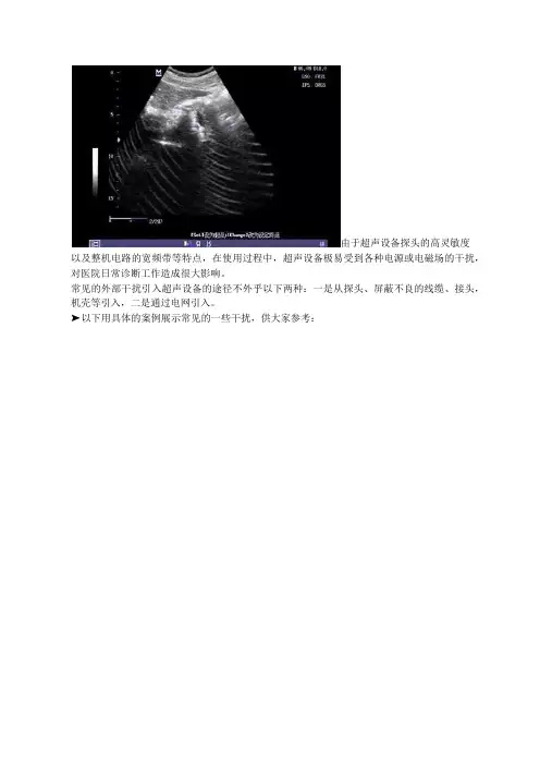 超声设备工作受干扰？常见故障和排查方法