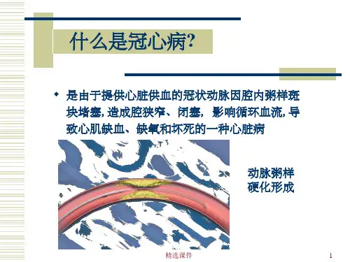 ACS的诊断和治疗课件