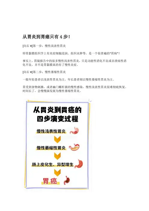 从胃炎到胃癌只有4步