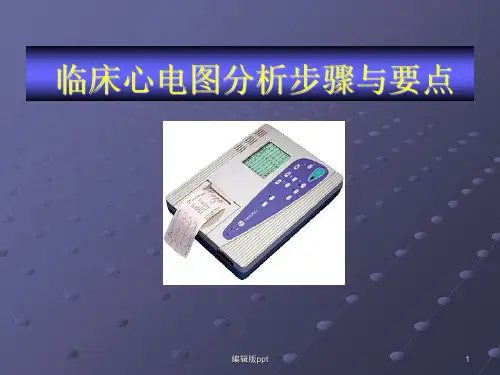 临床心电图教程心电图分析步骤与要点PPT医学课件