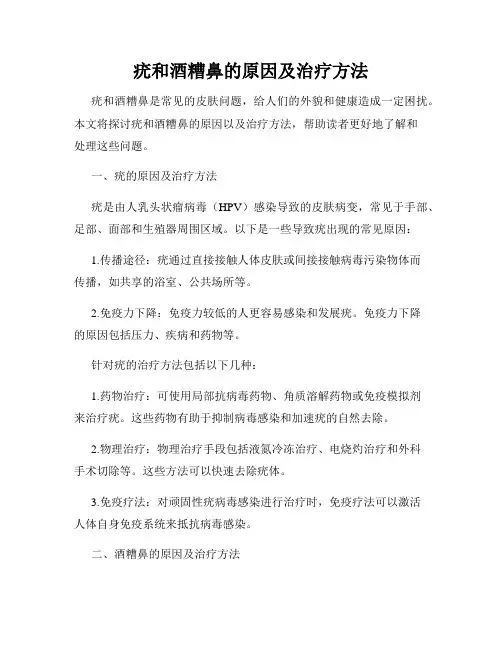 疣和酒糟鼻的原因及治疗方法
