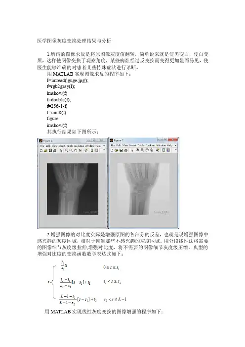 医学图像灰度变换处理结果与分析