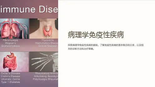 《病理学免疫性疾病》课件