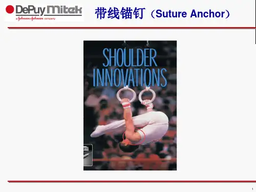 强生带线锚钉课件