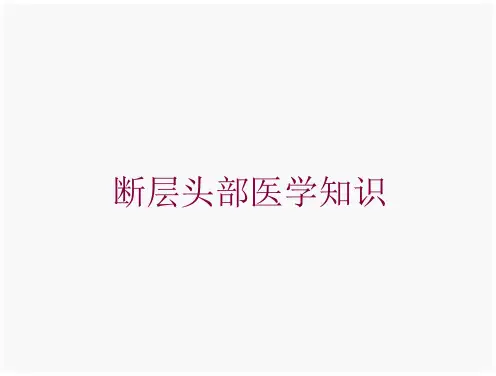断层头部医学知识培训ppt课件