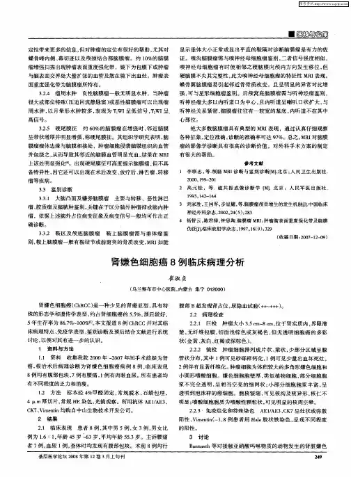 肾嫌色细胞癌8例临床病理分析