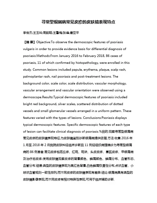 寻常型银屑病常见皮疹的皮肤镜表现特点