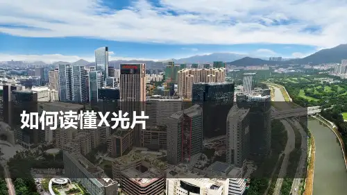 3.如何读懂X光片