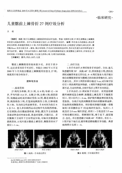 儿童髂前上棘骨折27例疗效分析
