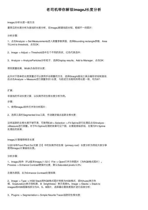 老司机带你解锁ImageJ长度分析