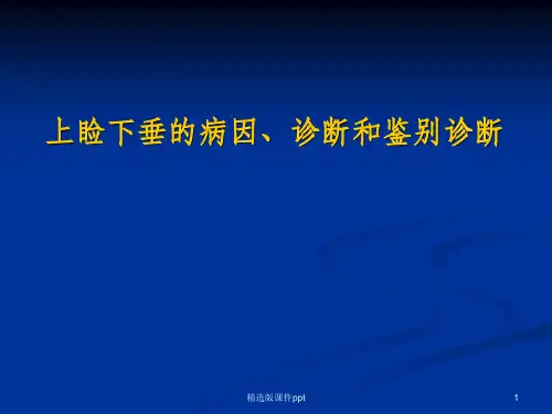 上睑下垂的病因诊断和鉴别诊断ppt课件