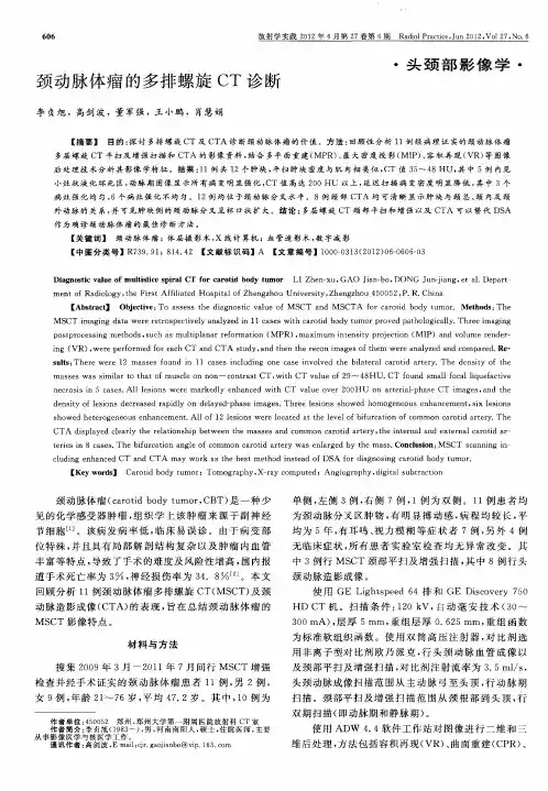 颈动脉体瘤的多排螺旋CT诊断