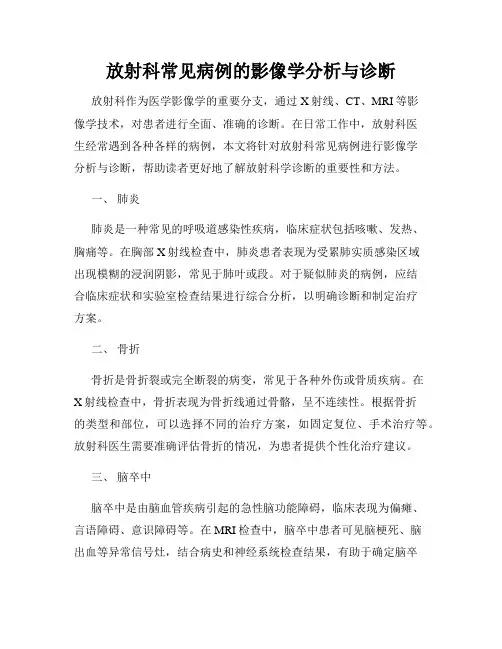 放射科常见病例的影像学分析与诊断