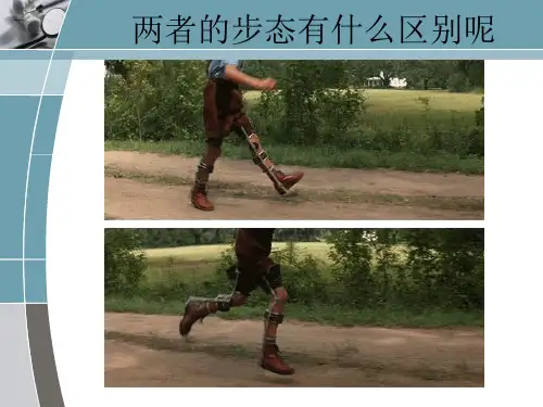 步态分析及其矫治训练