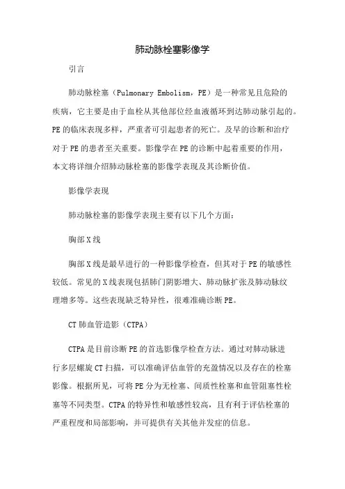 肺动脉栓塞影像学