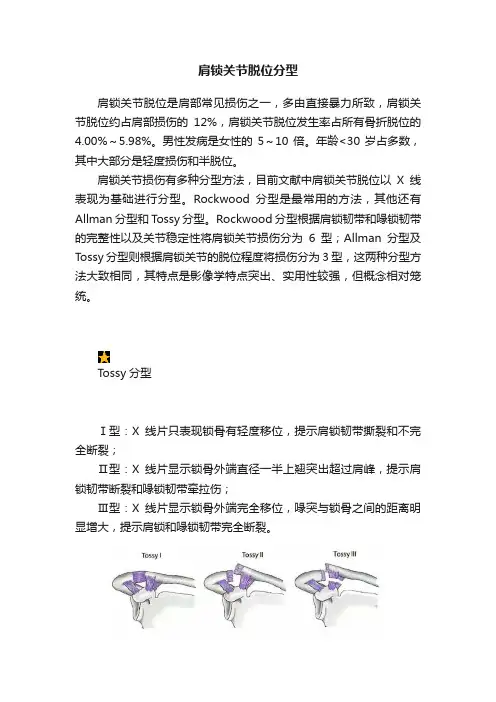 肩锁关节脱位分型