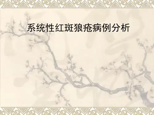 病例分析：系统性红斑狼疮病例分析