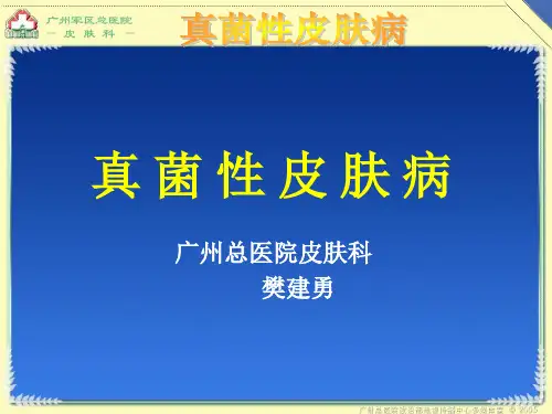 真菌性皮肤病PPT课件(文库推荐)