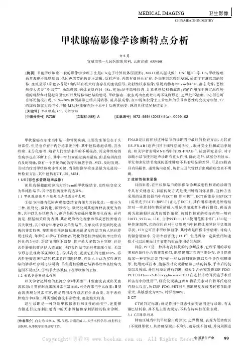 甲状腺癌影像学诊断特点分析