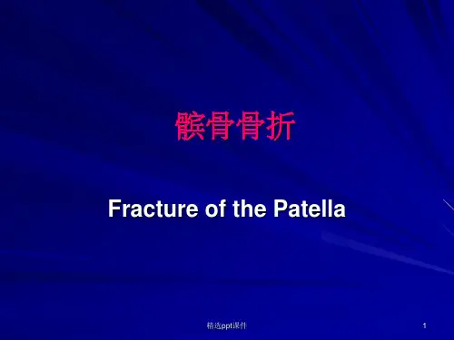 《髌骨骨折的治疗》PPT课件
