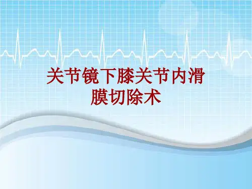 手术讲解模板：关节镜下膝关节内滑膜切除术