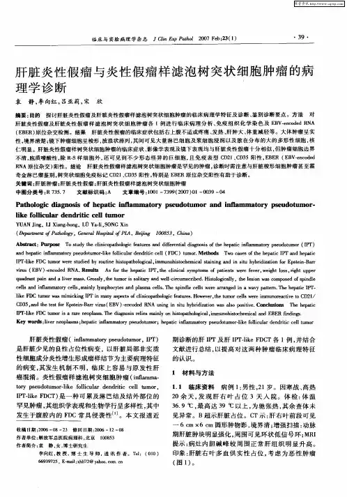 肝脏炎性假瘤与炎性假瘤样滤泡树突状细胞肿瘤的病理学诊断