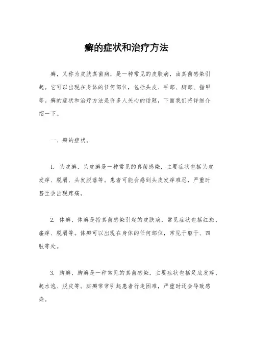 癣的症状和治疗方法