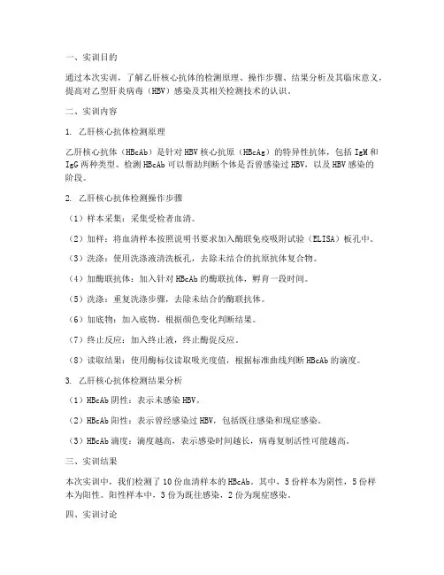乙肝核心抗体实训报告